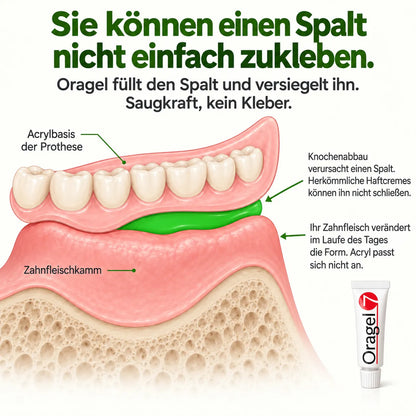 Oragel™